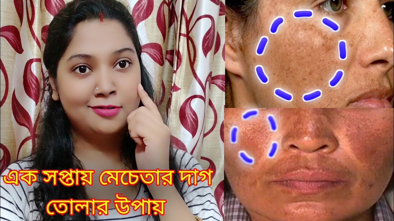 mecheta remove cream