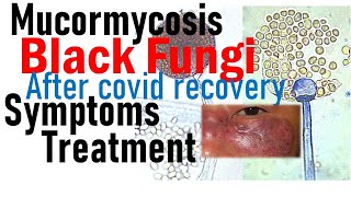 Symptoms of black fungus