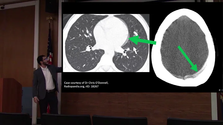 Dr. Adam Blumenberg: Artifacts in CT Scans