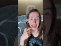 Bike Accident recap #braces #7months #update #orthodontist