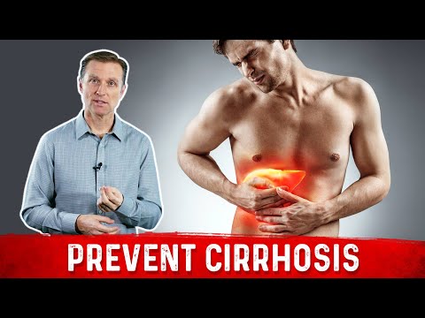 Best Herbs for Liver Cirrhosis