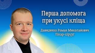 Перша допомога при укусі кліща