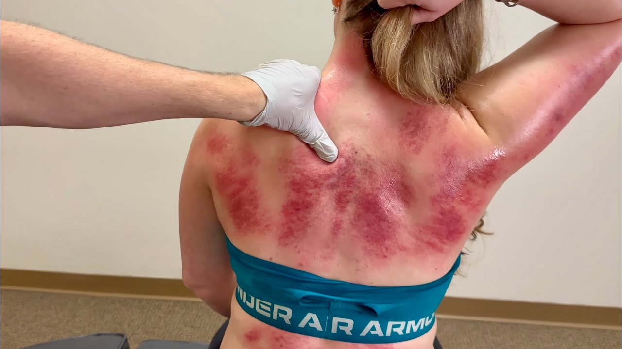 RELIEVING ALL THE STRESS