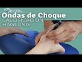 ONDAS DE CHOQUE - TRATAMIENTO CALCIFICACIÓN y TENDINITIS HAGLUNG Fisioterapia | Fisiolution