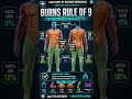 Burns Rule of 9 | TBSA Calculation NCLEX Quick Revision - Nootropic Nurse