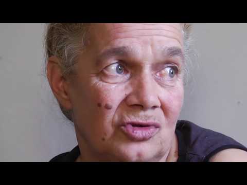 59 წლის ლარისა შაპარიოვა ლიფტში ჩავარდა და ფეხის მრავლობითი მოტეხილობა მიიღო