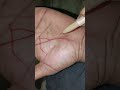 #hastrekhashashtra #palmistry#mountofvenus se rekha nikalkar jeevan rekha par traingle banati lucky