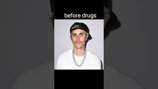celebrity before and after drugs justin bieber