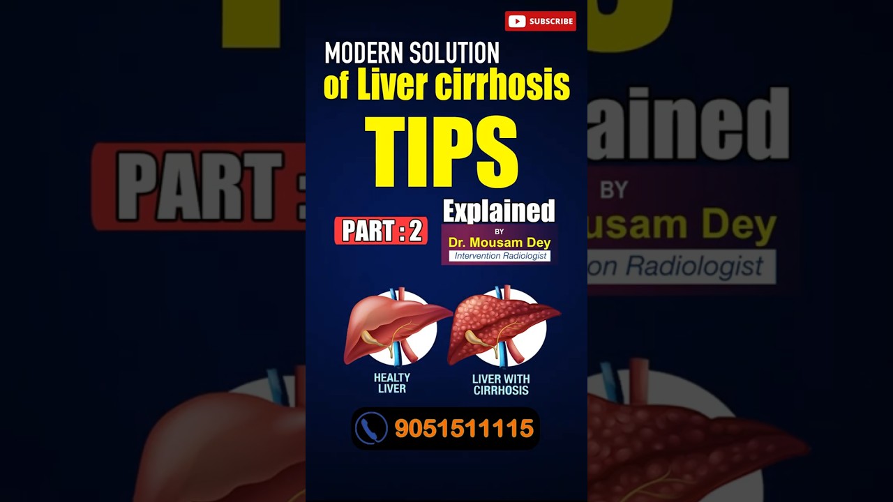 CIRRHOSIS OF LIVER (Modern Solution) | PART2 