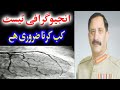 Angiography test kab karna zarori hai        by gen asif ali khan r