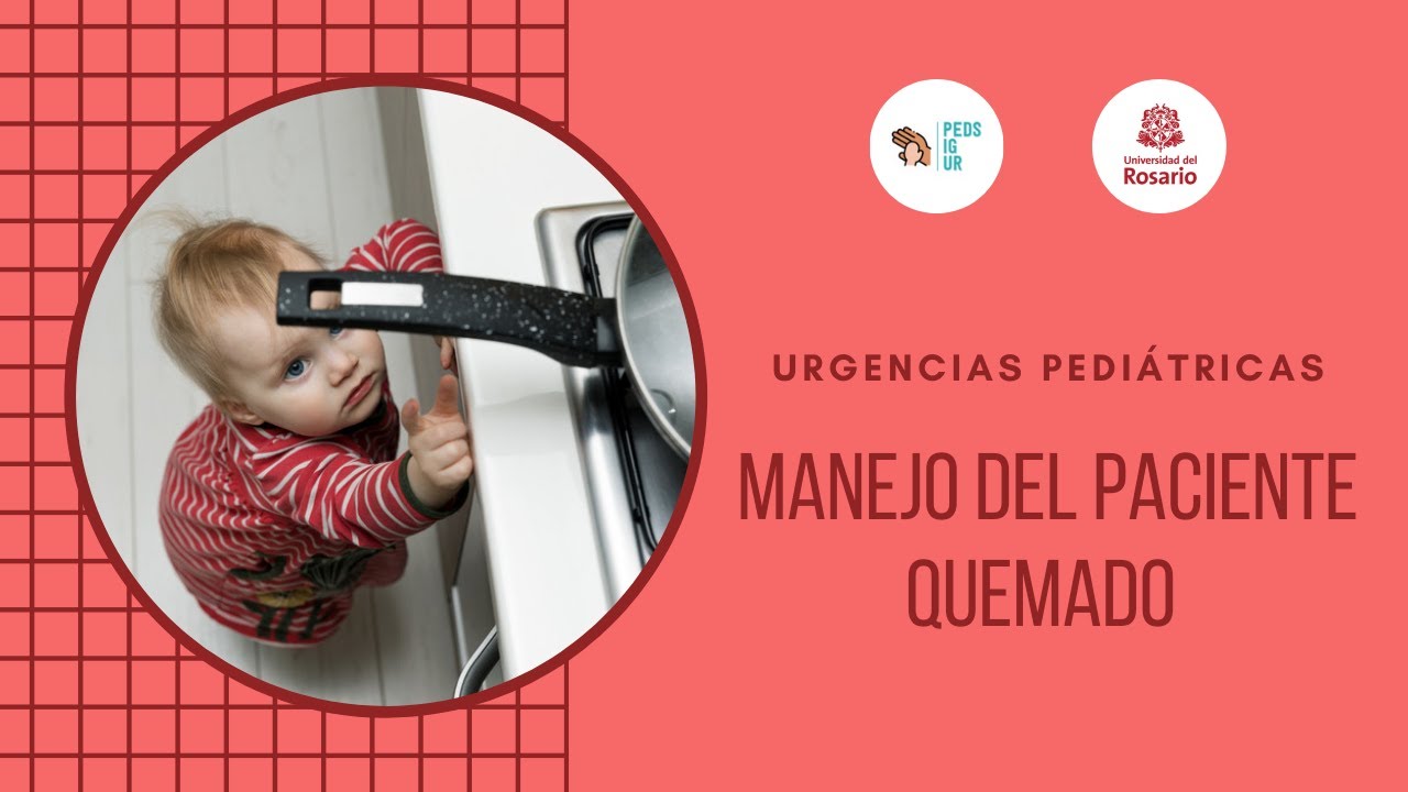 Manejo del paciente quemado - PEDS IG UR, Módulo de urgencias