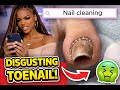 Nail Cleaning | ASMR Vibes #FootCare #nails  #Pedicure  #footsoak #pedicure