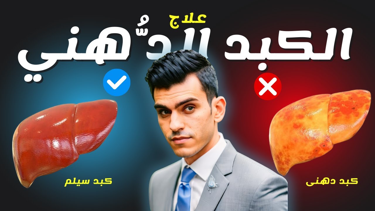 علاج الكبد الدهني بدون ادويه بطريقه طبيعيه