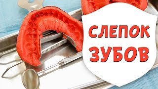 Слепок зубов для брекетов - весь процесс! Материалы для изготовления оттиска | Доктор Д | Дентал ТВ