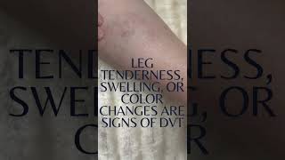 Swollen Leg It Could Be DVT—Don’t Wait to Get Checked! | Florida Podiatrist