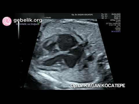 Video: Fetal Kalp Atışı Nasıl Belirlenir