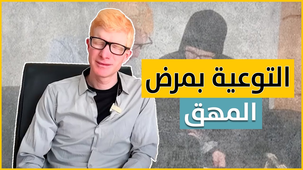 قصة زوجين من المغرب يعانيان من المهق