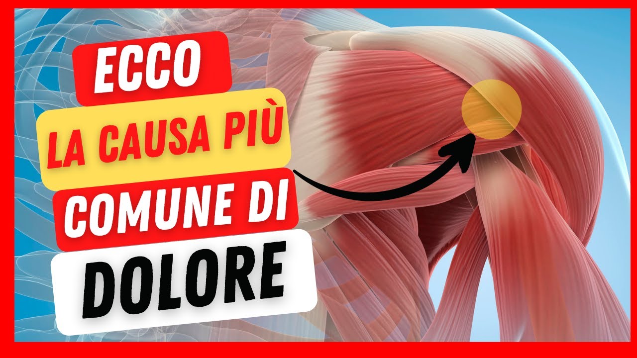 DOLORE alla SPALLA destra o sinistra quando ALZO il BRACCIO ⚠️ - YouTube