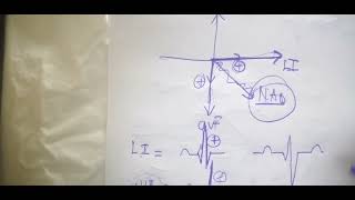 SchrDbb_ Measuring Axis deviation of the heart