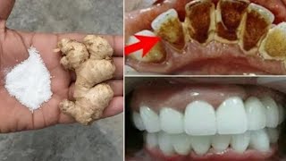 In 2 minutes, yellow will make dirty teeth white like pearl and shiny / Home remedy for teeth whiten