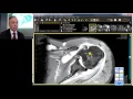 MRI Case Review: Shoulder Deep Dive