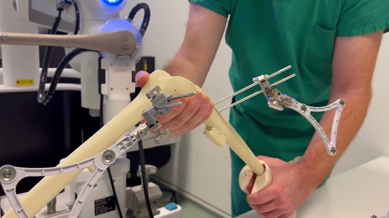 EOC certificato Velys Knee Robotics