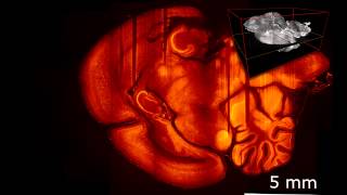 Mouse brain completely transparent