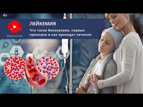 Лейкемия. Симптомы рака крови и основные методы лечения