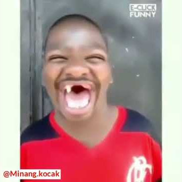 Orang gigi ompong