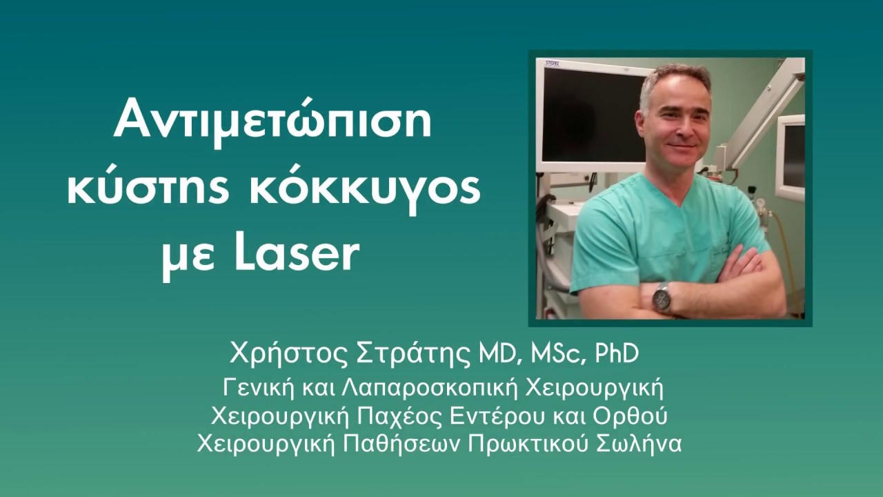 Αντιμετώπιση κύστης κόκκυγος με laser