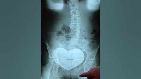 Gonstead Analysis Xray review