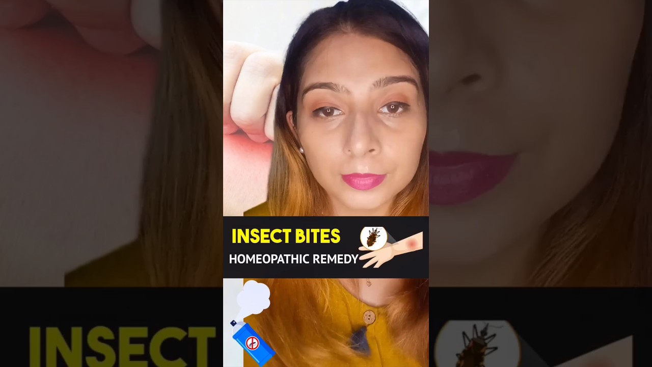 Homeopathic Medicine for Insect Bites and Stings! 👩‍⚕️⚕️ 