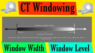 Celebrity CT Windowing in Hindi | Window Width in Hindi | Window Level in Hindi | Basics Of CT Scan Profile