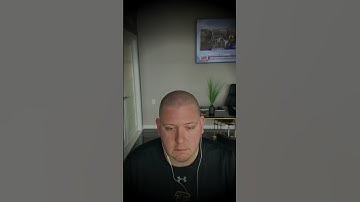 Gorgeous scalp micropigmentation result - light skin