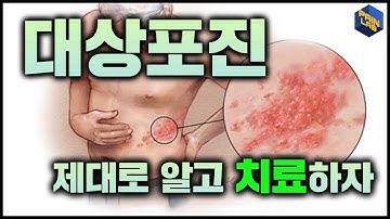 대상포진이 궁금하다구요? - 페인랩이 말하는 통증이야기