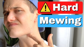Hard Mewing for FASTER RESULTS (Not For Beginners)
