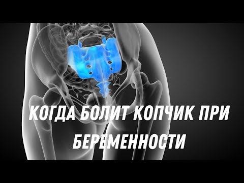 Когда болит копчик при беременности #doctorberezovska #olenaberezovska #беременность