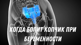 Когда болит копчик при беременности #doctorberezovska #olenaberezovska #беременность