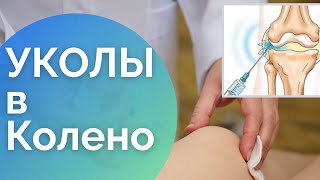 УКОЛ В КОЛЕННЫЙ СУСТАВ | Гиалуроновая Кислота Для Суставов | Лечение Артроза