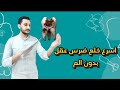 اسرع خلع ضرس عقل ممكن تشوفه Lower Wisdom Tooth Extraction Dr Abdullah Sultan Dentist 