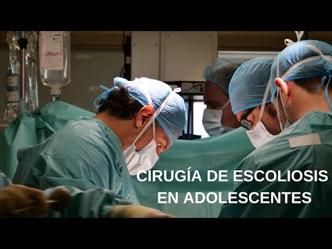 Video: Cómo lidiar con la cirugía de escoliosis: 10 pasos (con imágenes)