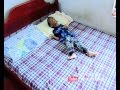 Baby Navneetha suffering from strange