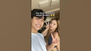 Korean Plastic Surgery is the best ✨
