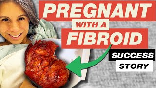 PREGNANT WITH FIBROIDS | HIGH RISK PREGNANCY