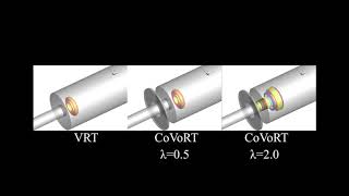 Celebrity Vortex ring thruster using the Coanda effect Net Worth