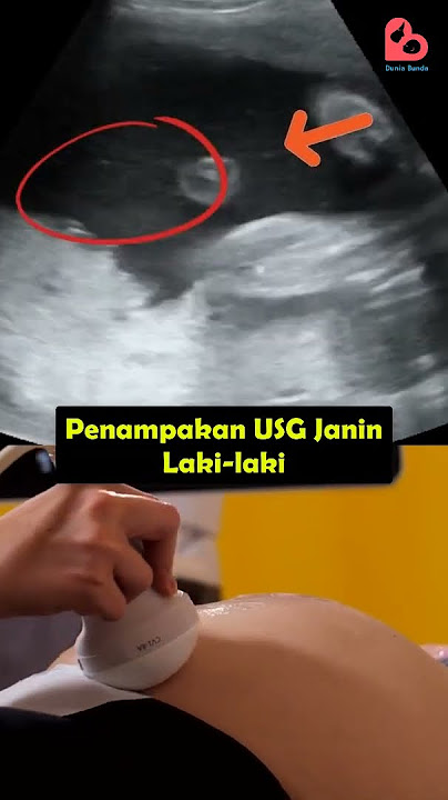 Penampakan Janin Laki-laki saat Ibu Hamil USG #kehamilan