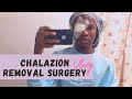Chalazion Removal Surgery! | VLOG (Part 1)
