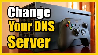 How To Change Dns Server On Xbox Series X Fast Tutorial