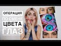 ОПЕРАЦИЯ ПО СМЕНЕ ЦВЕТА ГЛАЗ