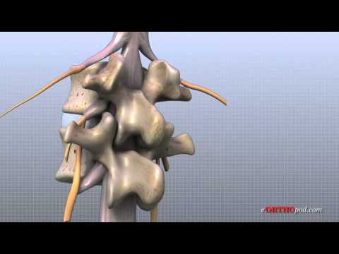 Dr. Casden Performs Anterior Cervical Spine Surgery. 